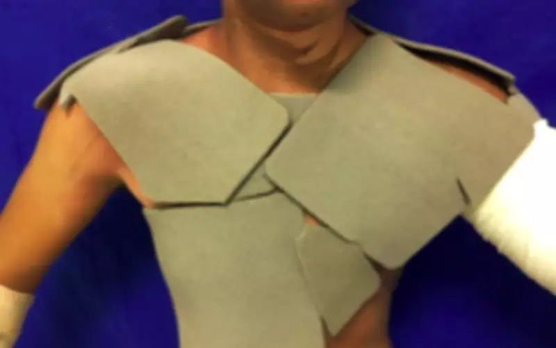 Curativo de espuma com prata reduz custos e dor em tratamento de queimaduras