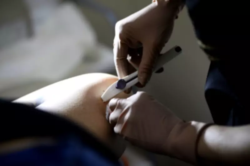 Distrito Federal inicia oferta do contraceptivo Implanon pelo SUS em unidades básicas