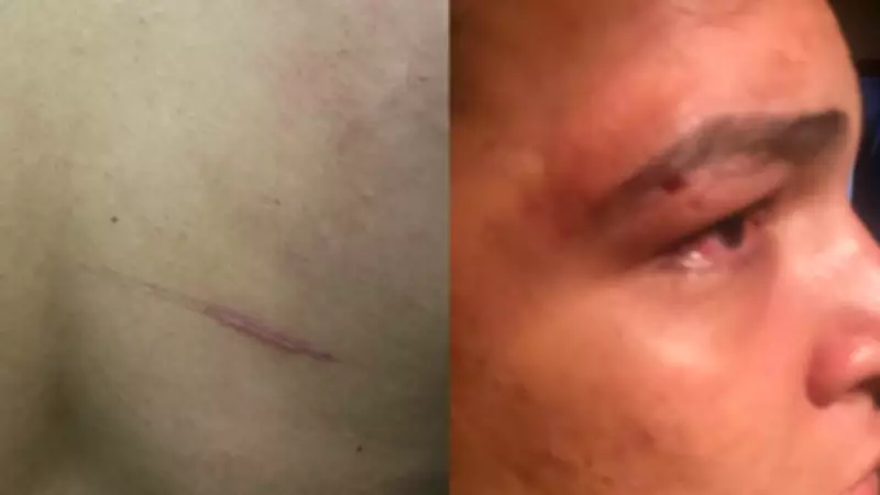 Empresário é agredido por PMs após confusão em Luzilândia, Piauí