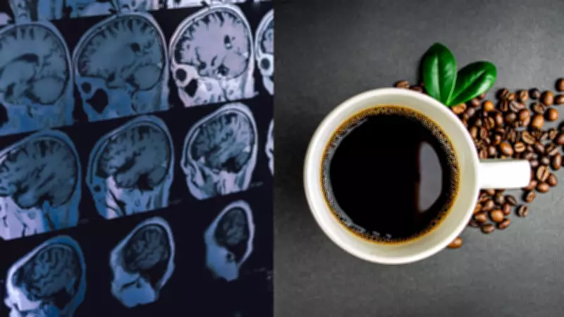 Estudo de Harvard e MIT revela que café pode reduzir risco de demência em até 20%