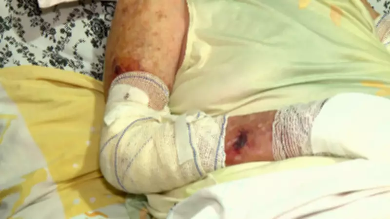 Família denuncia ferimentos em idosa após troca de sonda em UPA de Rio Claro