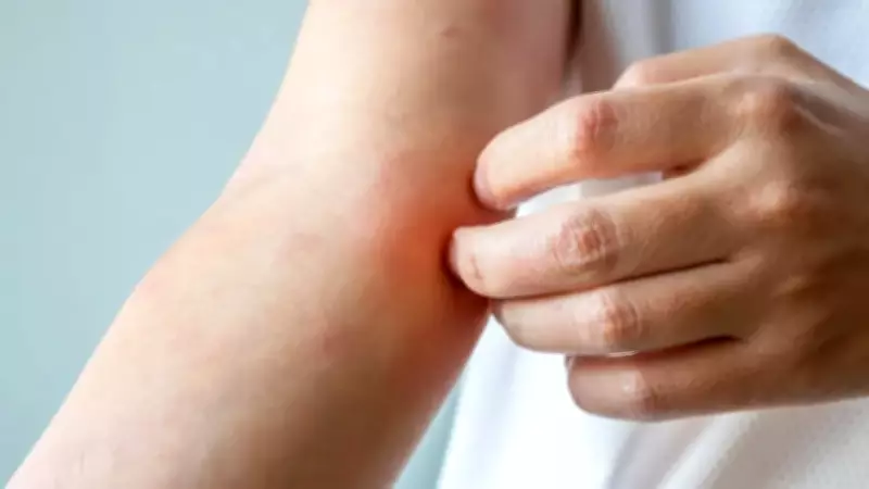 Fungo sexualmente transmissível TMVII se espalha globalmente e preocupa autoridades de saúde