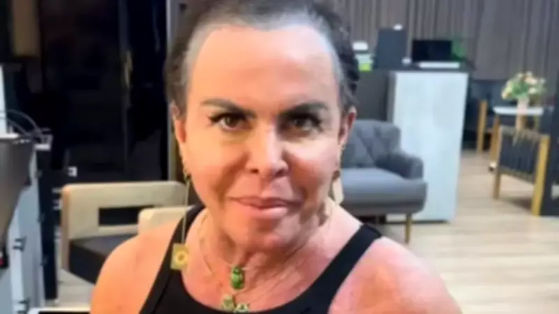 Gretchen revela alopecia e doa prótese capilar em gesto solidário após Carnaval