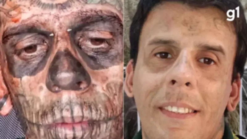 Homem que foi 'mais tatuado do Brasil' mostra rosto irreconhecível após sessões de remoção