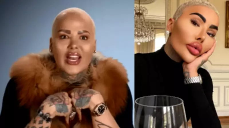 Influenciador 'Rei dos Lábios' morre após caso de homicídio culposo por BBL