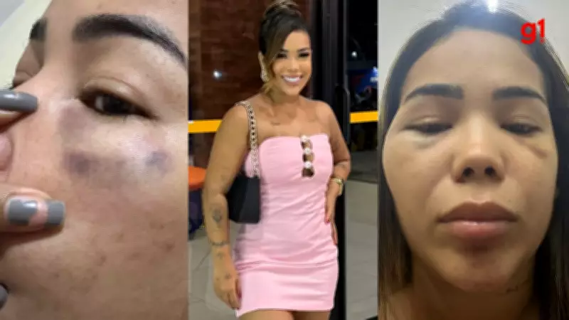 Influenciadora denuncia agressões por ex-namorado em Teresina; suspeito é preso