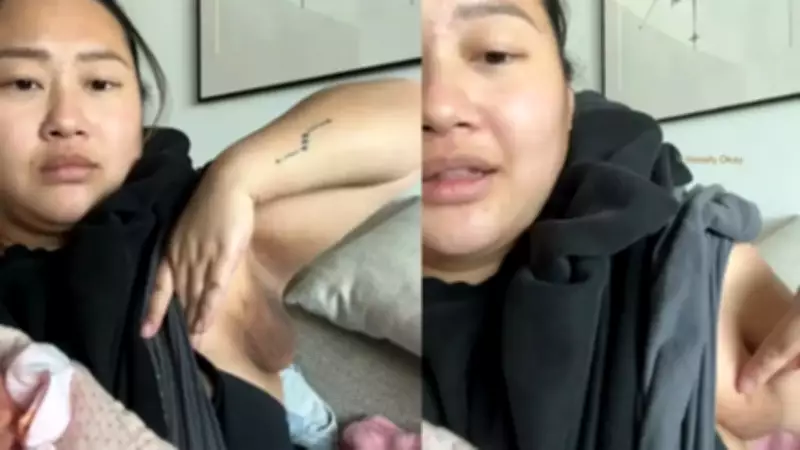 Influenciadora revela ter desenvolvido terceiro mamilo na axila durante amamentação