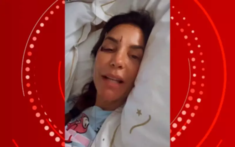 Ivete Sangalo aparece com olho roxo após desmaio e internação em Salvador