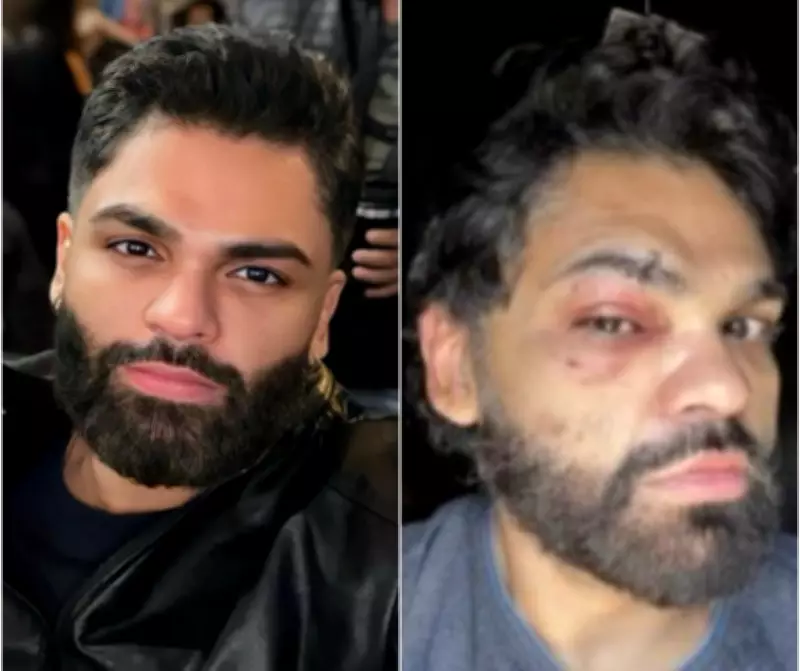 Justiça de Cuiabá rejeita queixa-crime por injúria qualificada em caso de agressão homofóbica