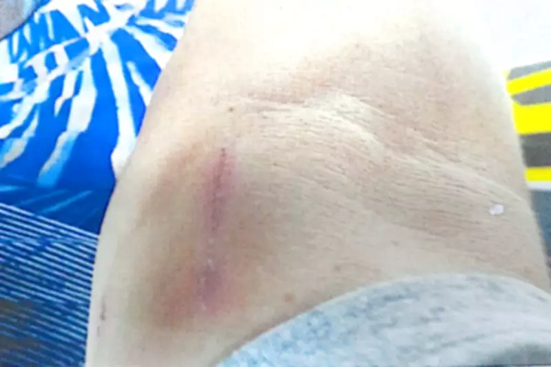 Justiça de SP nega indenização a motorista agredido com enxada em Itanhaém