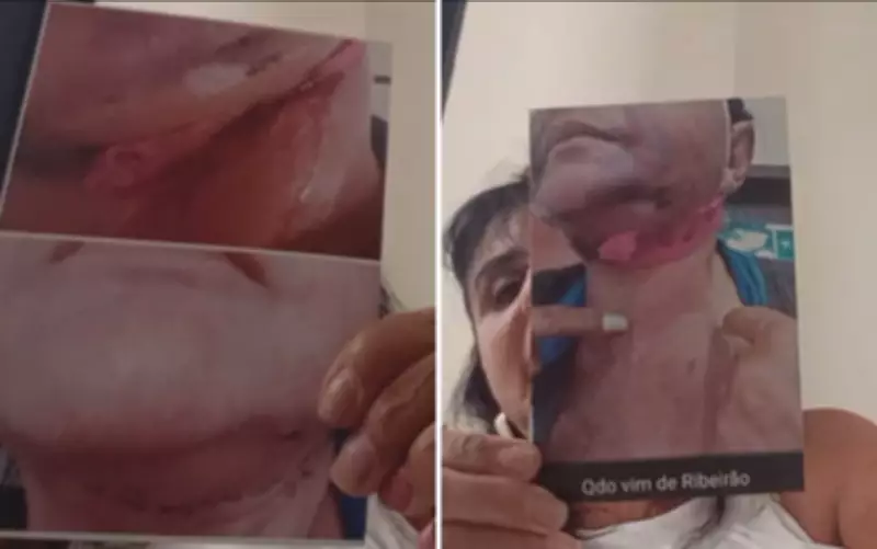 Laudo do IML confirma lesões graves em mais uma paciente de dentista de Ribeirão Preto