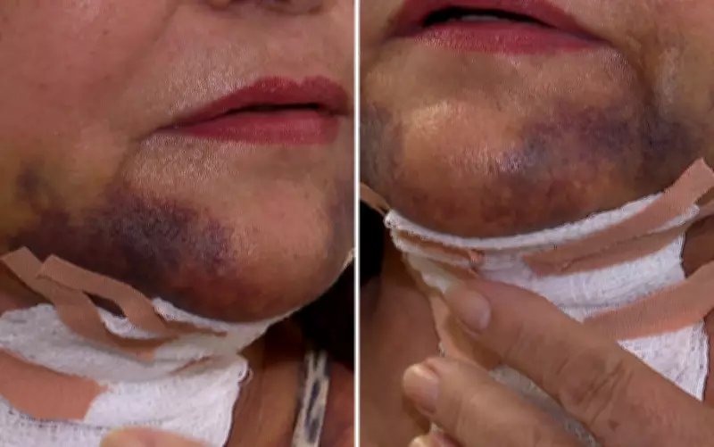 Laudo pericial revela perigo de vida após cirurgia estética com dentista em Ribeirão Preto