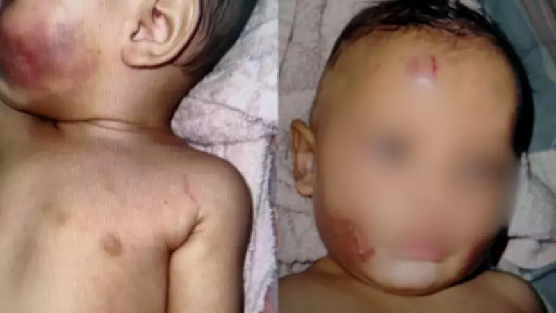 Mãe e padrasto são presos por morder bebê de 7 meses em Vila Velha, ES