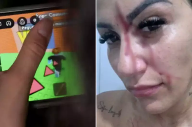 Mãe tem rosto cortado ao tentar resolver briga de filhos iniciada no Roblox em Praia Grande