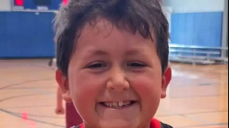 Menino de 9 anos sofre queimaduras no rosto ao seguir desafio viral do TikTok
