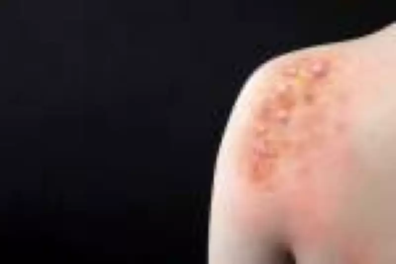 Mpox retorna ao Brasil: especialista explica por que a vigilância em saúde deve ser contínua