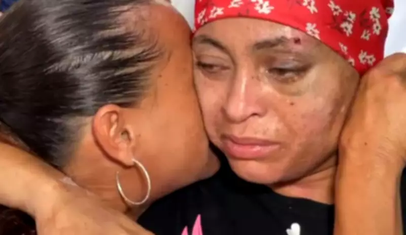 Mulher declarada morta por engano após atropelamento recebe alta em Bauru após 19 dias