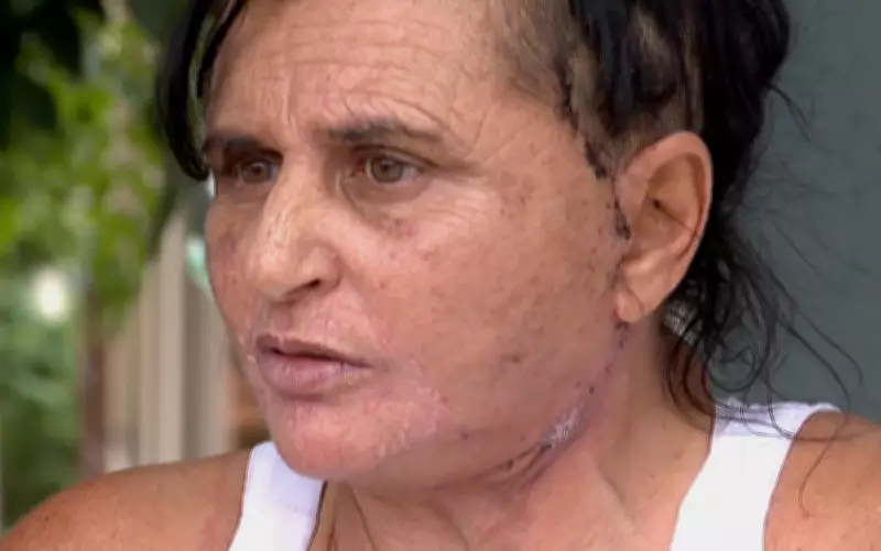 Mulher denuncia complicações graves após procedimento estético feito por dentista em Ribeirão Preto
