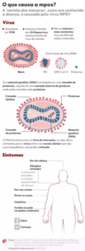 Nova cepa recombinante do vírus da mpox é identificada no Reino Unido e na Índia