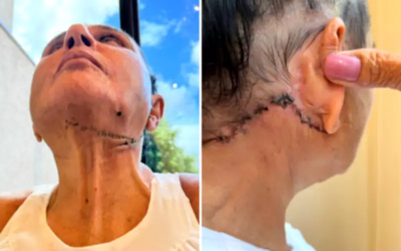 Professora aposentada denuncia dentista após complicações graves em procedimentos estéticos em Ribeirão Preto