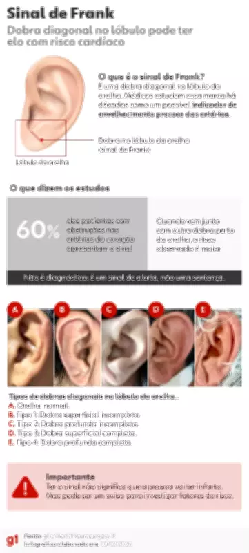 Sinal de Frank: Dobra na Orelha Pode Indicar Risco Cardíaco, Após Caso de Maderite