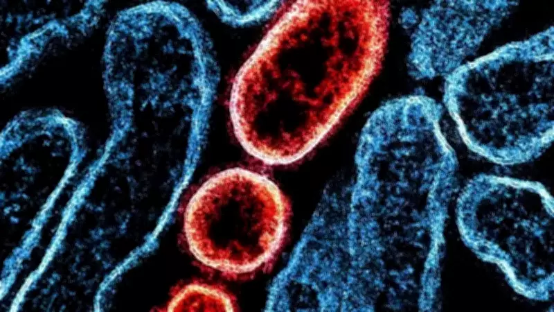 Surto do vírus Nipah na Índia: especialistas descartam risco de epidemia no Brasil