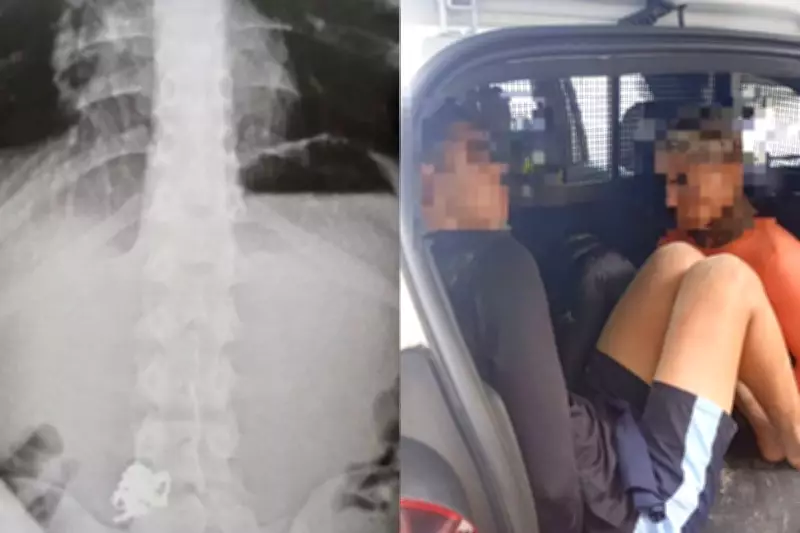 Suspeito engole correntes de ouro roubadas durante tentativa de fuga em Guarujá