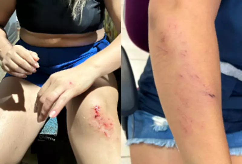 Técnica de enfermagem é atacada e ameaçada de morte em terra indígena Yanomami