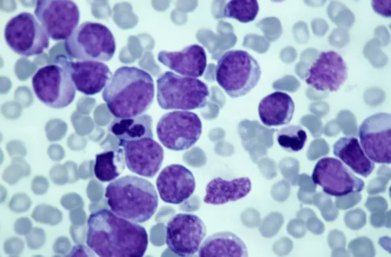 Terapias-alvo triplicam sobrevida na leucemia, mas acesso a testes moleculares desafia Brasil
