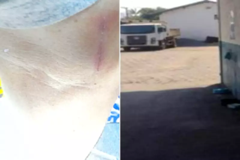 TJ-SP nega indenização a motorista agredido com cabo de enxada em Itanhaém