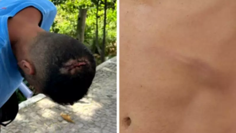 Turista mineiro é agredido após questionar conta de R$ 215 em quiosque de Vila Velha