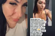 Cabeleireira tem rosto e peito cortados com vidro em Praia Grande; agressora posta crime