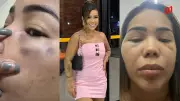 Influenciadora denuncia agressões por ex-namorado em Teresina; suspeito é preso