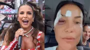 Ivete Sangalo é internada após desmaio por síncope vasovagal em Salvador