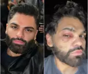 Justiça de Cuiabá rejeita queixa-crime por injúria qualificada em caso de agressão homofóbica