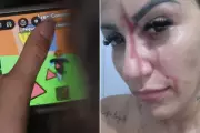 Mãe tem rosto cortado ao tentar resolver briga de filhos iniciada no Roblox em Praia Grande