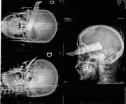 Mulher de 41 anos é esfaqueada pelo companheiro em São Carlos, SC, em tentativa de feminicídio