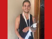 Sargento da PM recebe alta após acidente com capivara no Acre