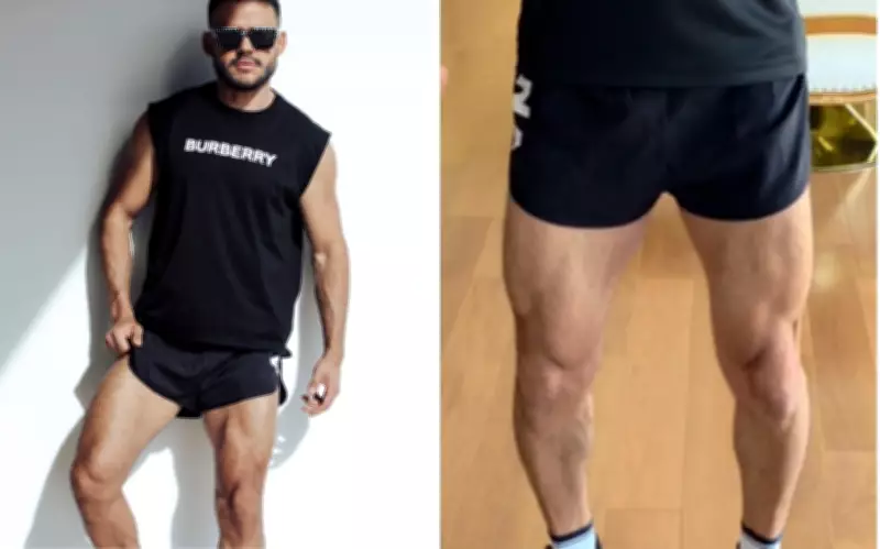 Academia condenada a pagar R$ 20 mil por advertir aluno sobre short considerado inadequado