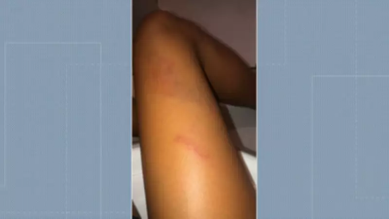 Aluna de 12 anos é agredida por colega em banheiro de escola municipal no Rio