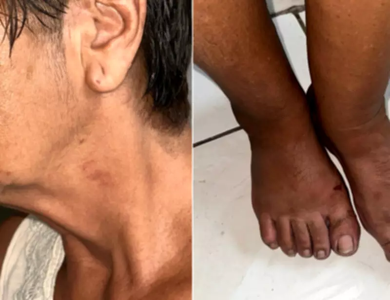 Aposentada de 70 anos é estuprada em Cabo Frio após ser imobilizada com golpe de gravata