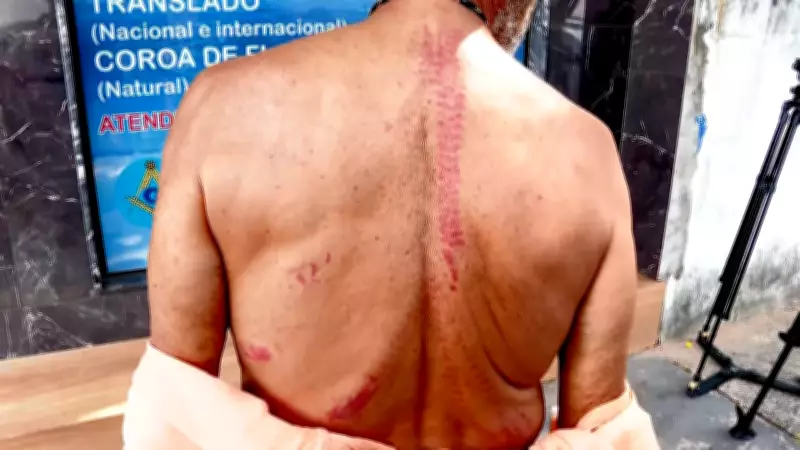 Argentino de 64 anos é espancado durante assalto em casa na Serra, ES