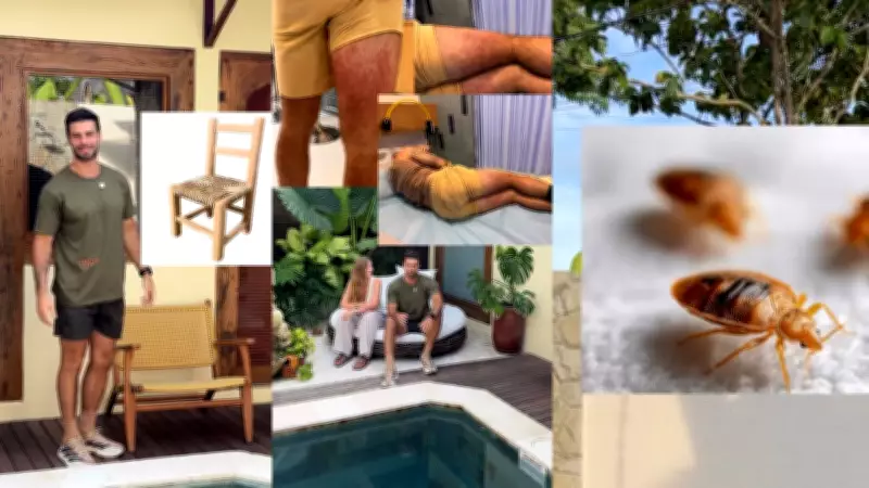 Ator Lucas Malvacini sofre reação alérgica grave em Bali após picadas de percevejos