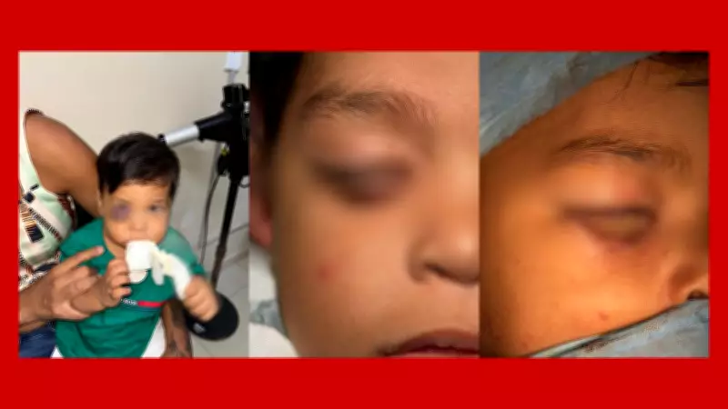 Bebê de Brasília supera tumor raro com cirurgia de reconstrução de pálpebra