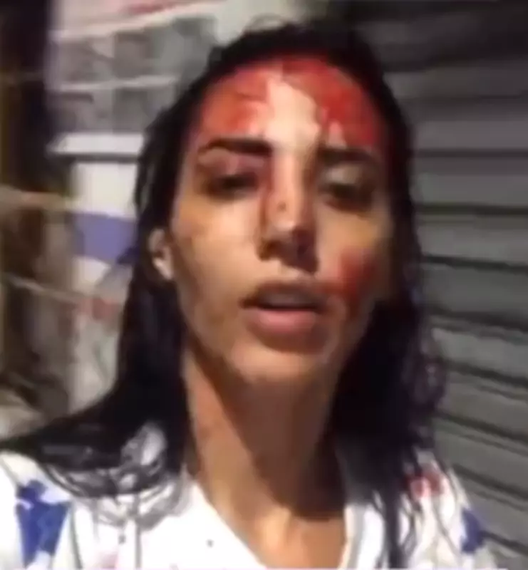 Bia Correia, com sangue no rosto, alega legítima defesa após esfaquear namorado em Maceió