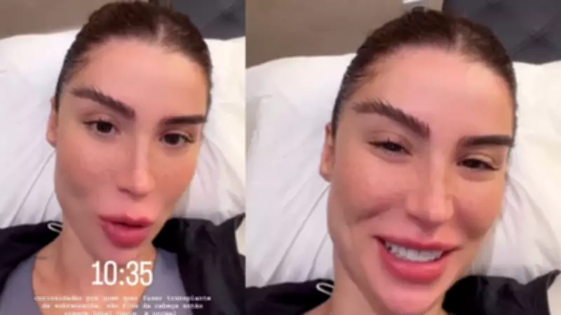 Boca Rosa revela transplante de sobrancelha: entenda como funciona e os riscos do procedimento