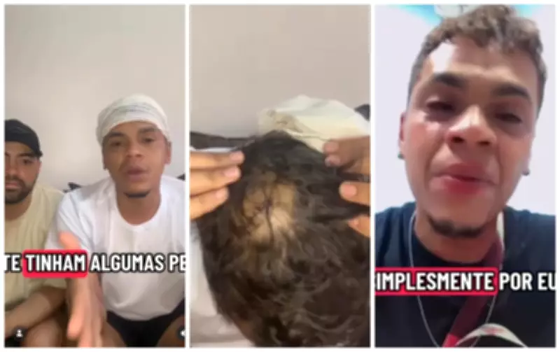 Casal gay sofre agressão brutal com madeira, chutes e facada em Sorocaba, SP