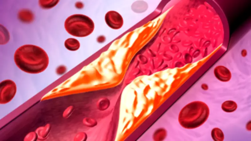 Cereais açucarados no café da manhã ameaçam saúde do coração, alertam cardiologistas