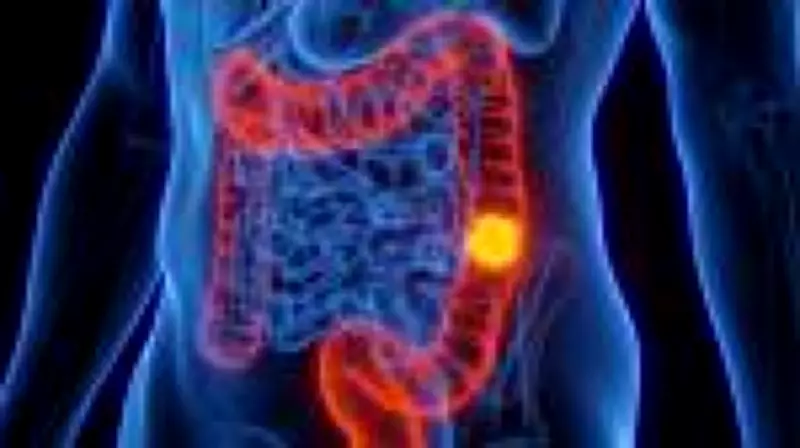 Câncer colorretal: casos aumentam entre jovens e prevenção é fundamental