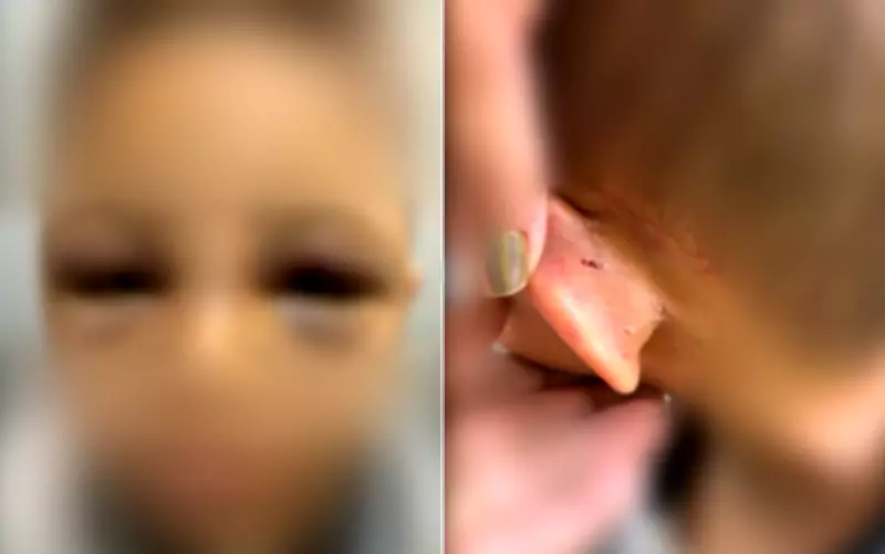 Criança de 6 anos é internada com sinais de maus-tratos após agressões do pai em Goiânia